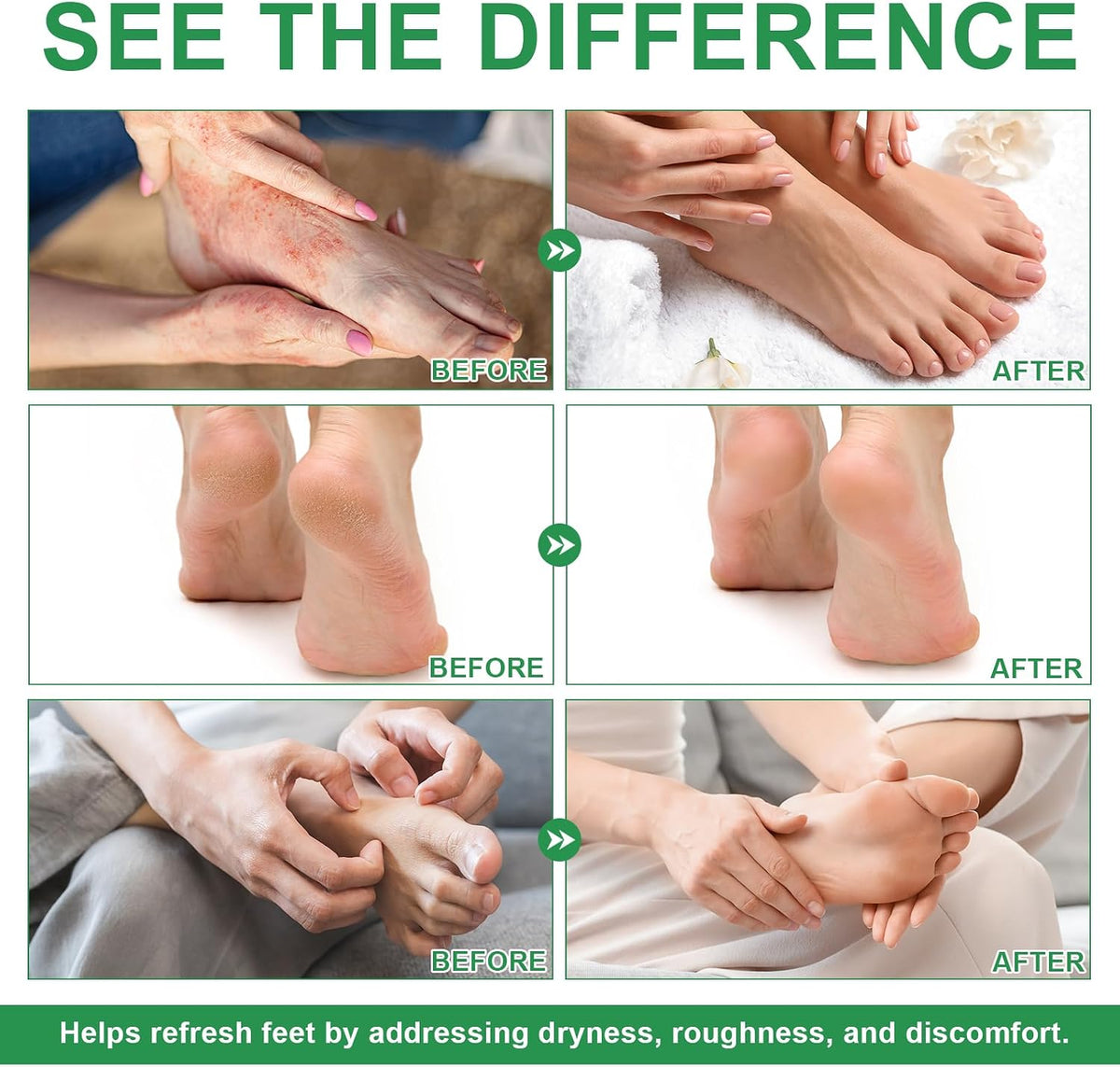 Foot Tea Tree Oil Spray - Odor Control & Itch Relief with Tea Tree Oil | 120ml (4oz) | Natural Foot Deodorizer for Fresh, Clean Feet.