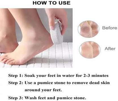 2PCS Natural Pumice Stone for Feet – Lava Foot File Callus Remover for Hard Skin, Cracked Heels & Dead Skin Exfoliation Tool