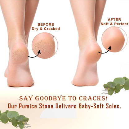 BEAUTICONE 100% Natural Terracotta Pumice Stone for Feet - Durable Callus Remover for Cracked Heels & Dead Skin - Dual Sided Foot Scrubber Pedicure Tool for Foot Care, Foot Exfoliator