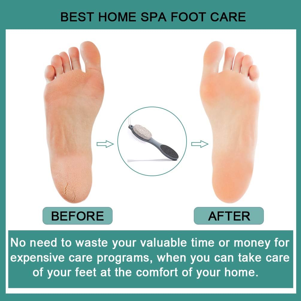 CAREHOOD Foot File Callus Remover - Foot Scrubber Pedicure Tool (Grey)