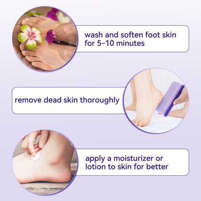 4 Pcs Foot Pumice Stone and Scrubber for Feet and Heels Callus and Dead Skins (Purple)