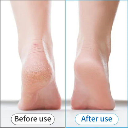 4 in 1 Foot Scrubber with Pumice Stone – Foot File Callus Remover for Dead Skin, Foot Brush for Shower, Foot Rasp and Sand Paper Pedicure Tools, Home Foot Care Kit for Dry Feet