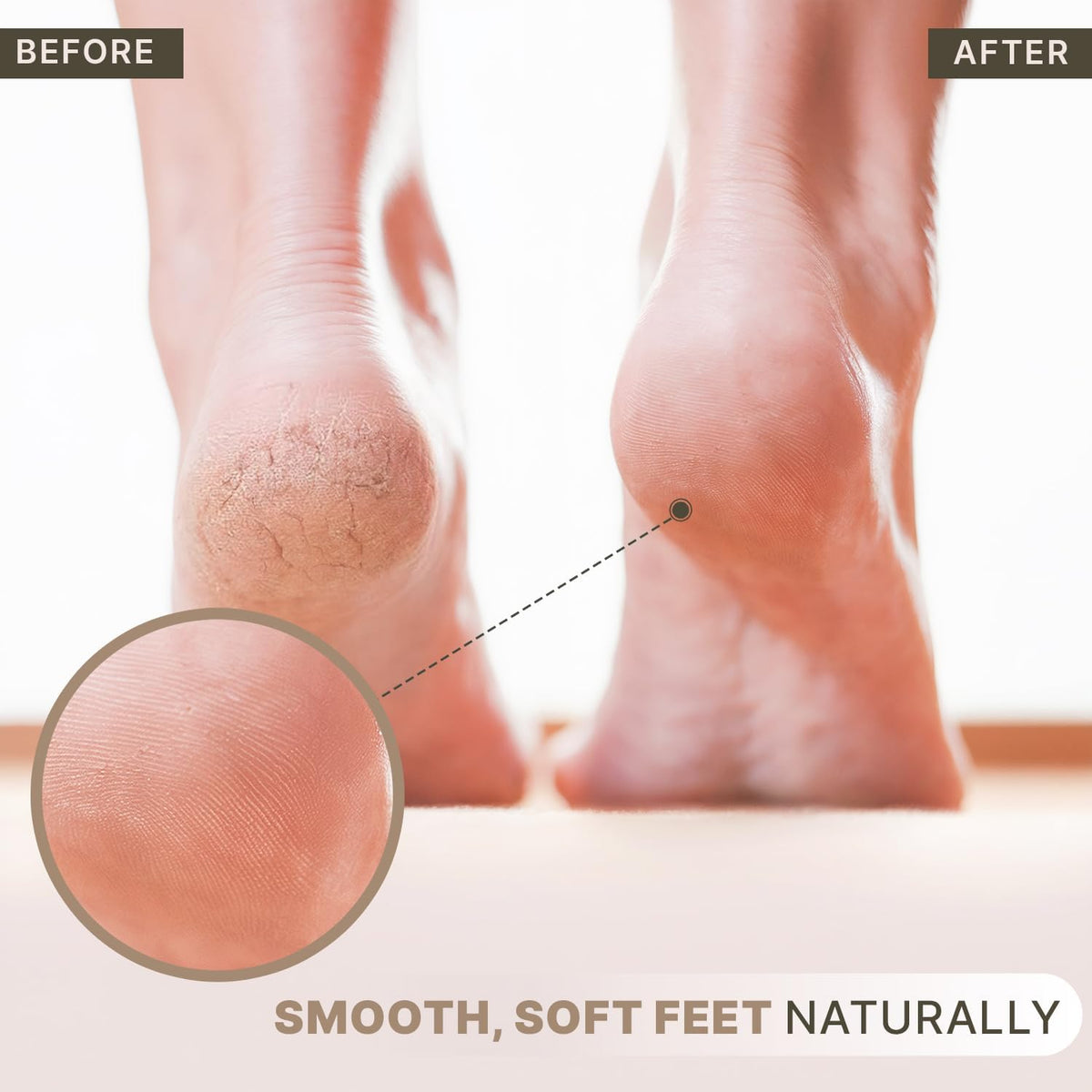 Pumice Stone for Feet - Natural Lava Stone Foot Exfoliator