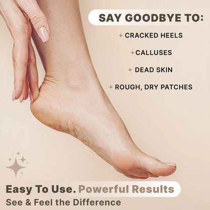 Pumice Stone for Feet - Natural Lava Stone Foot Exfoliator