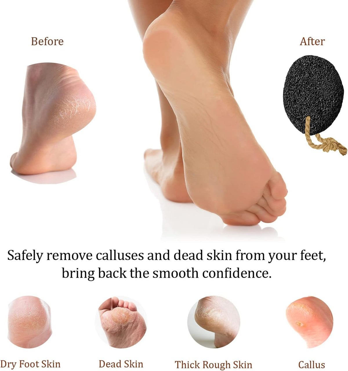 Pumice Stone for Feet - Natural Foot Scrubber for Dead Skin Callus Removal