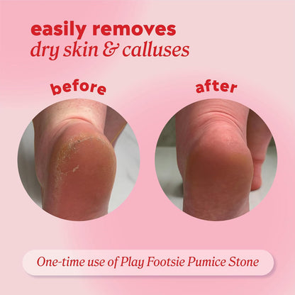 Onyx Professional Double Sided Pumice Stone for Feet, 2 pk - 100% Siliglass