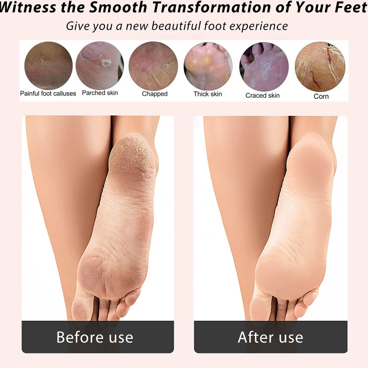 ICANdOIT 4 in 1 Bamboo Foot File Callus Remover Pedicure Scrubber Brush