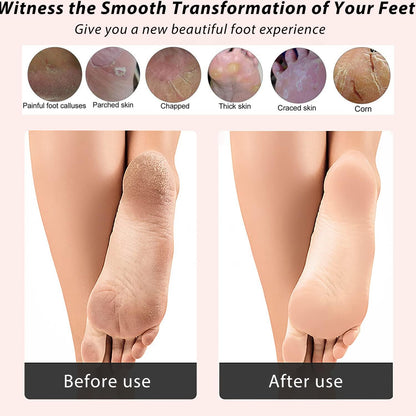 ICANdOIT 4 in 1 Bamboo Foot File Callus Remover Pedicure Scrubber Brush