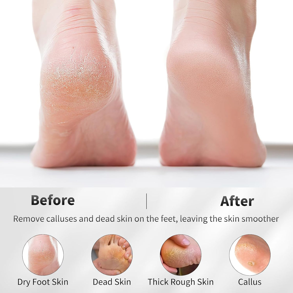 4 PCS Natural Volcanic Pumice Stone for Feet to Remove Dead Skin