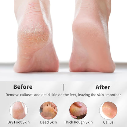 4 PCS Natural Volcanic Pumice Stone for Feet to Remove Dead Skin