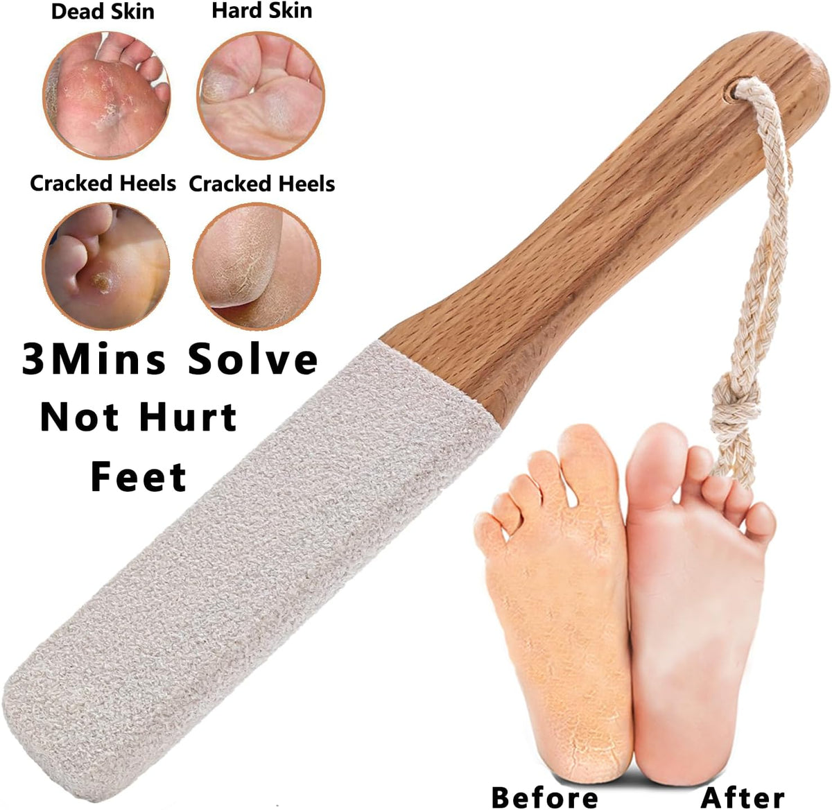 Kinepi Callus Remover Foot File, Pumice Stone for Feet Scrubber Wet and Dry