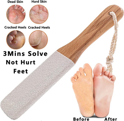 Kinepi Callus Remover Foot File, Pumice Stone for Feet Scrubber Wet and Dry