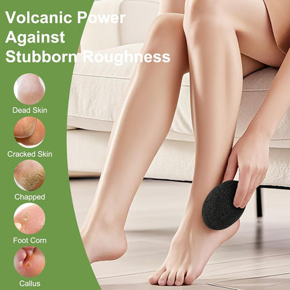 Pumice Stone for Feet, 3 Pack Natural Earth Lava Foot Callus Remover