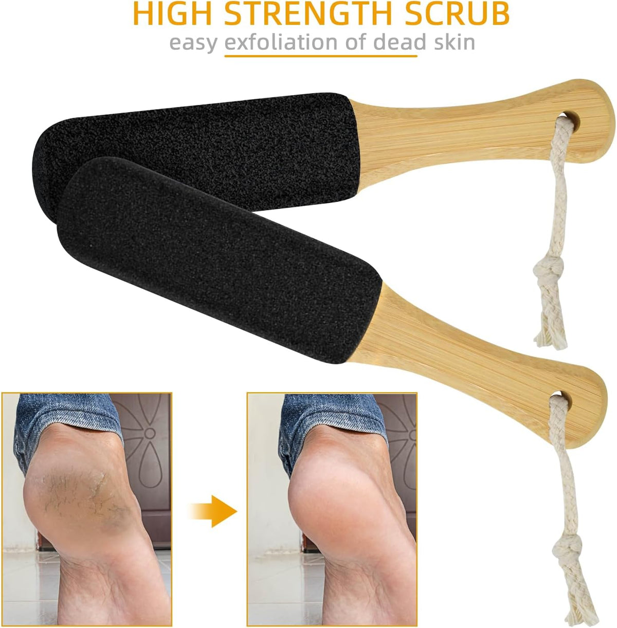 Dead Skin Remover for Feet – Smooth with Pumice Stone Foot File
