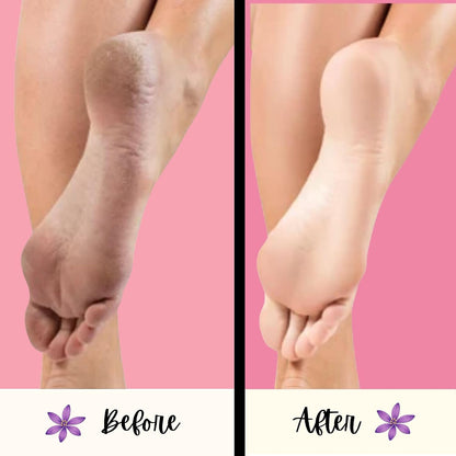 Mr. Pumice Purple PUMI Bar - Coarse Pumice Stone for Feet Callus Remover Pedicure Tools for Feet Foot Scrubber Skin Exfoliator Block, 4 Pack
