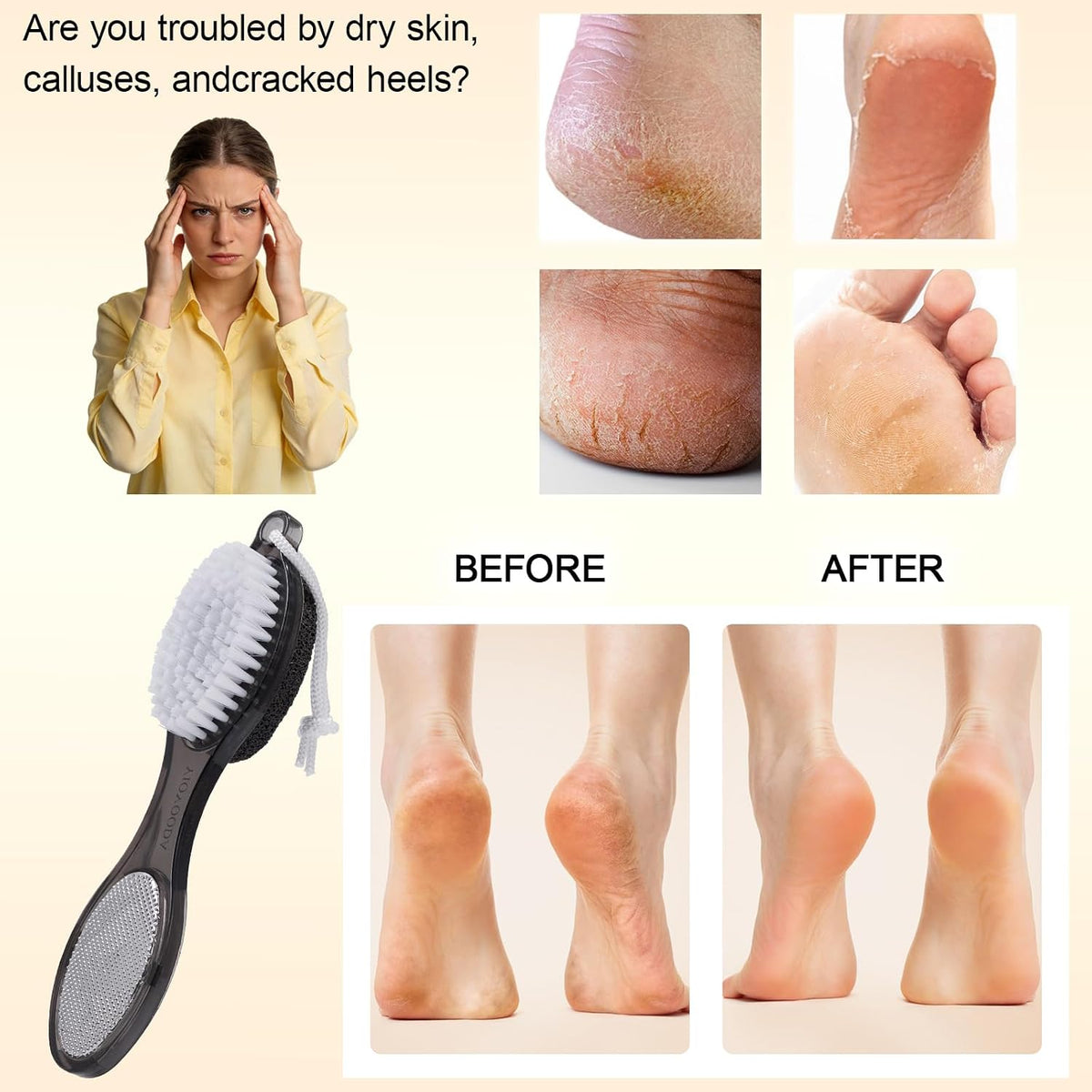 Foot Brush and Pumice Stone for Feet Scrub Callus Remover Pedicure Tools