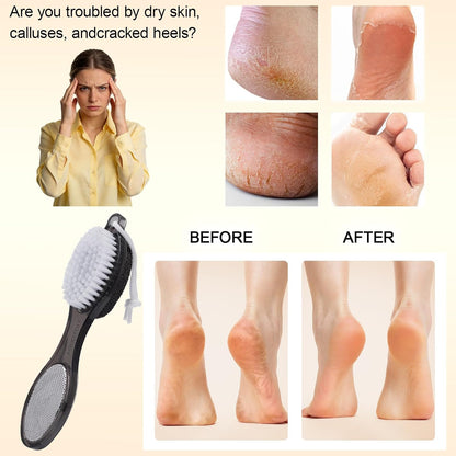 Foot Brush and Pumice Stone for Feet Scrub Callus Remover Pedicure Tools