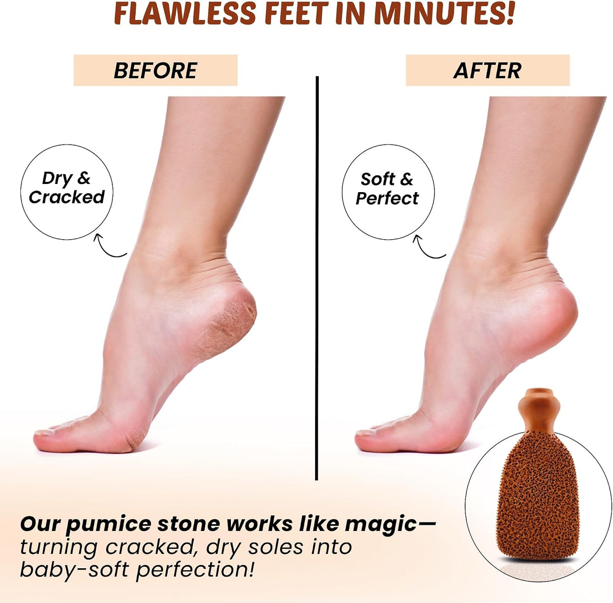 POHS Rectangular Pumice Stone – Callus Remover & Exfoliator for Feet & Body, Foot Scrubber for Shower, Natural Pumice Stone for Smooth Skin