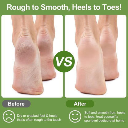 Pumice Stone for Feet, 3 Pack Natural Earth Lava Foot Callus Remover