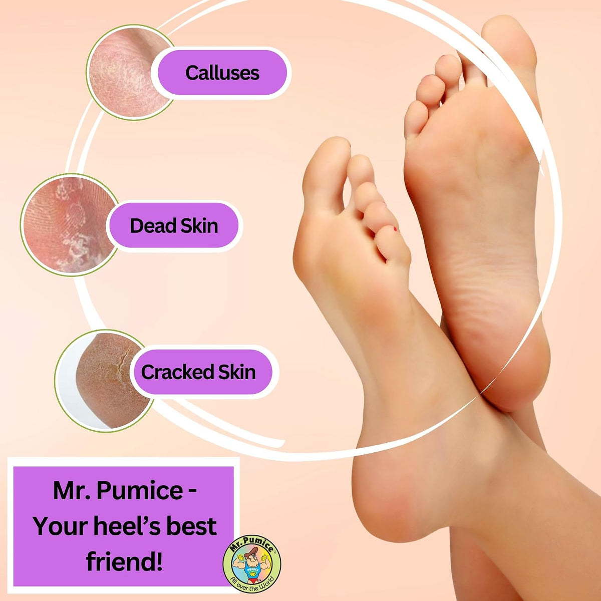 Mr. Pumice Purple PUMI Bar - Coarse Pumice Stone for Feet Callus Remover Pedicure Tools for Feet Foot Scrubber Skin Exfoliator Block, 4 Pack