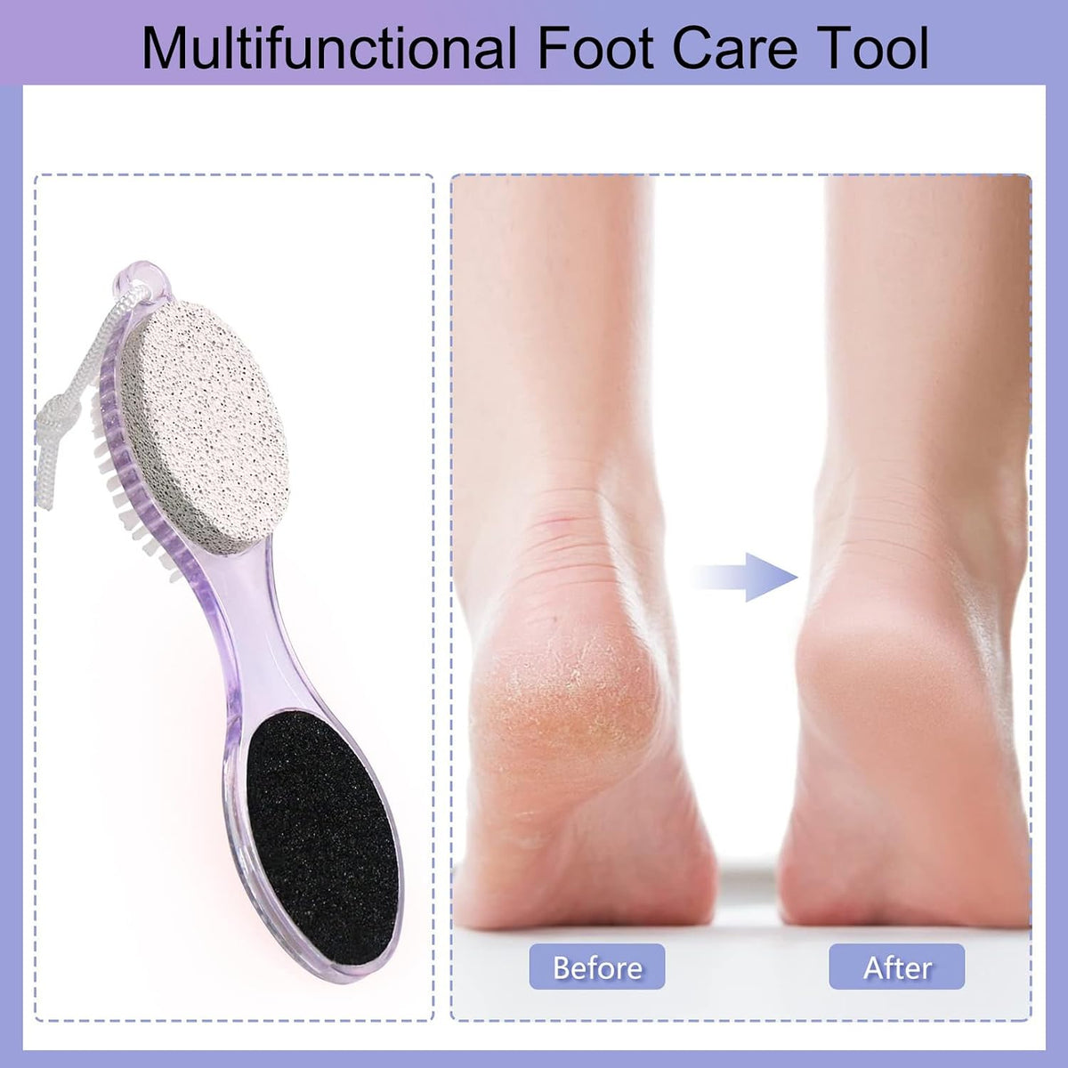 2 Pack 4-in-1 Foot Scrubber with Pumice Stone for Feet