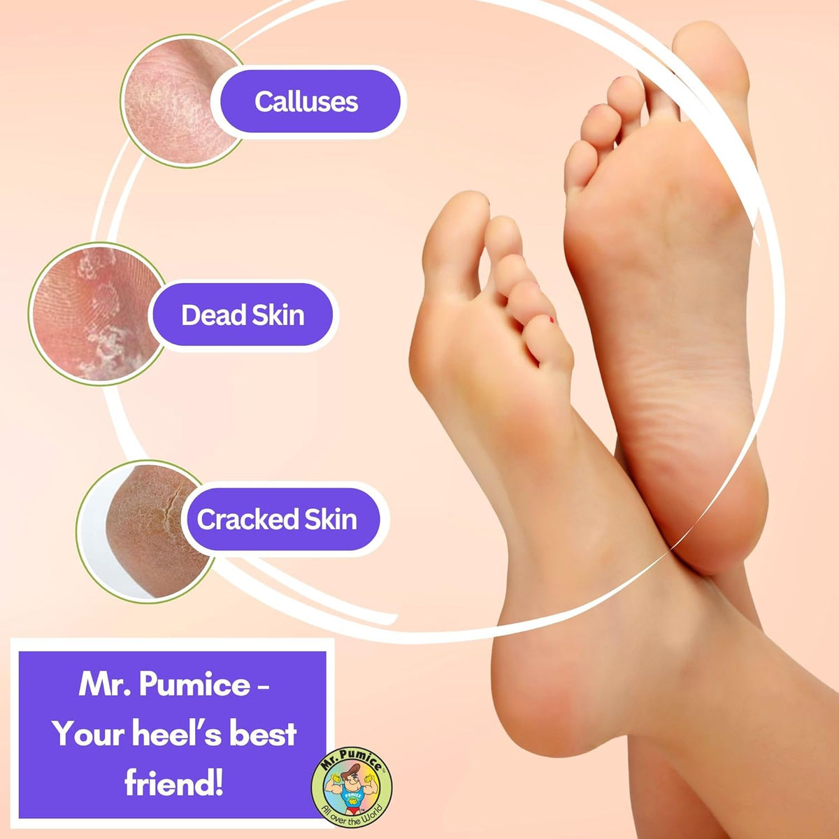 Mr. Pumice Ultimate PUMI Bar 2-in-1 Dual Grit (Medium + Coarse) Callus Remover, Pedicure Stone & Ped File Scrubber for Smooth Feet and Heels (4 Pack)