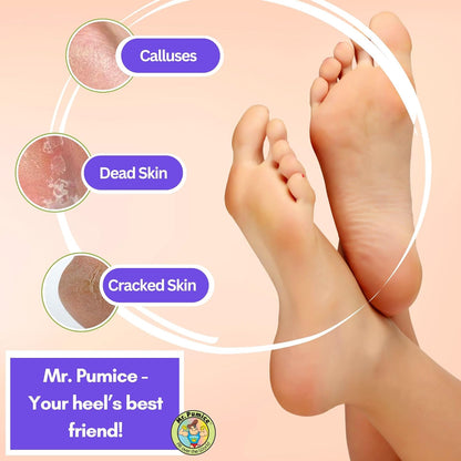 Mr. Pumice Ultimate PUMI Bar 2-in-1 Dual Grit (Medium + Coarse) Callus Remover, Pedicure Stone & Ped File Scrubber for Smooth Feet and Heels (4 Pack)