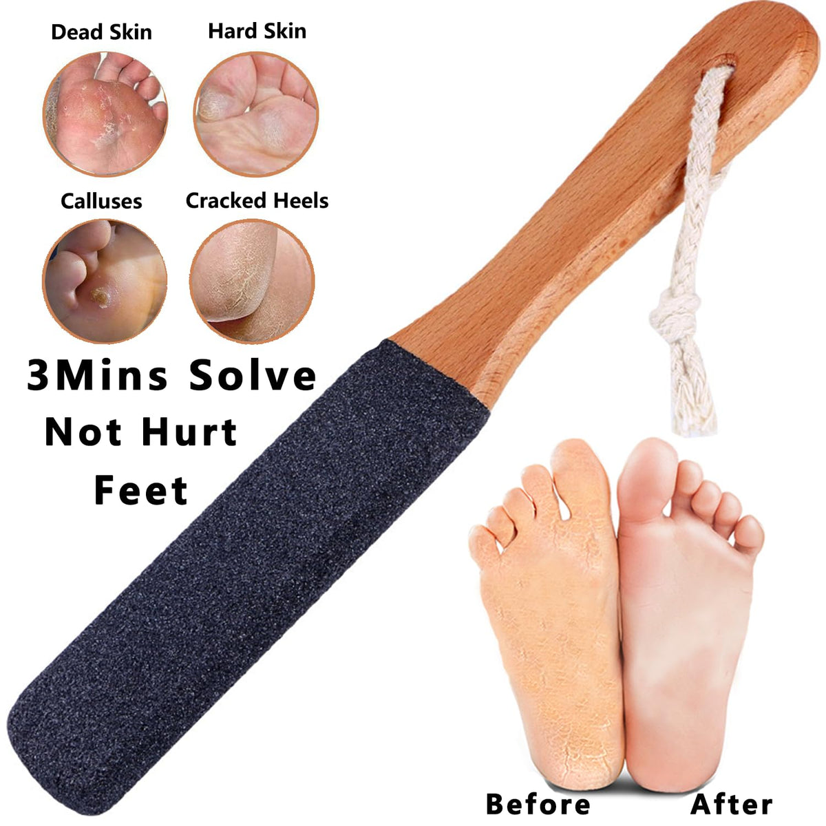 Kinepi Foot File & Foot Scrubber,Pumice Stone for Feet Callus Remover