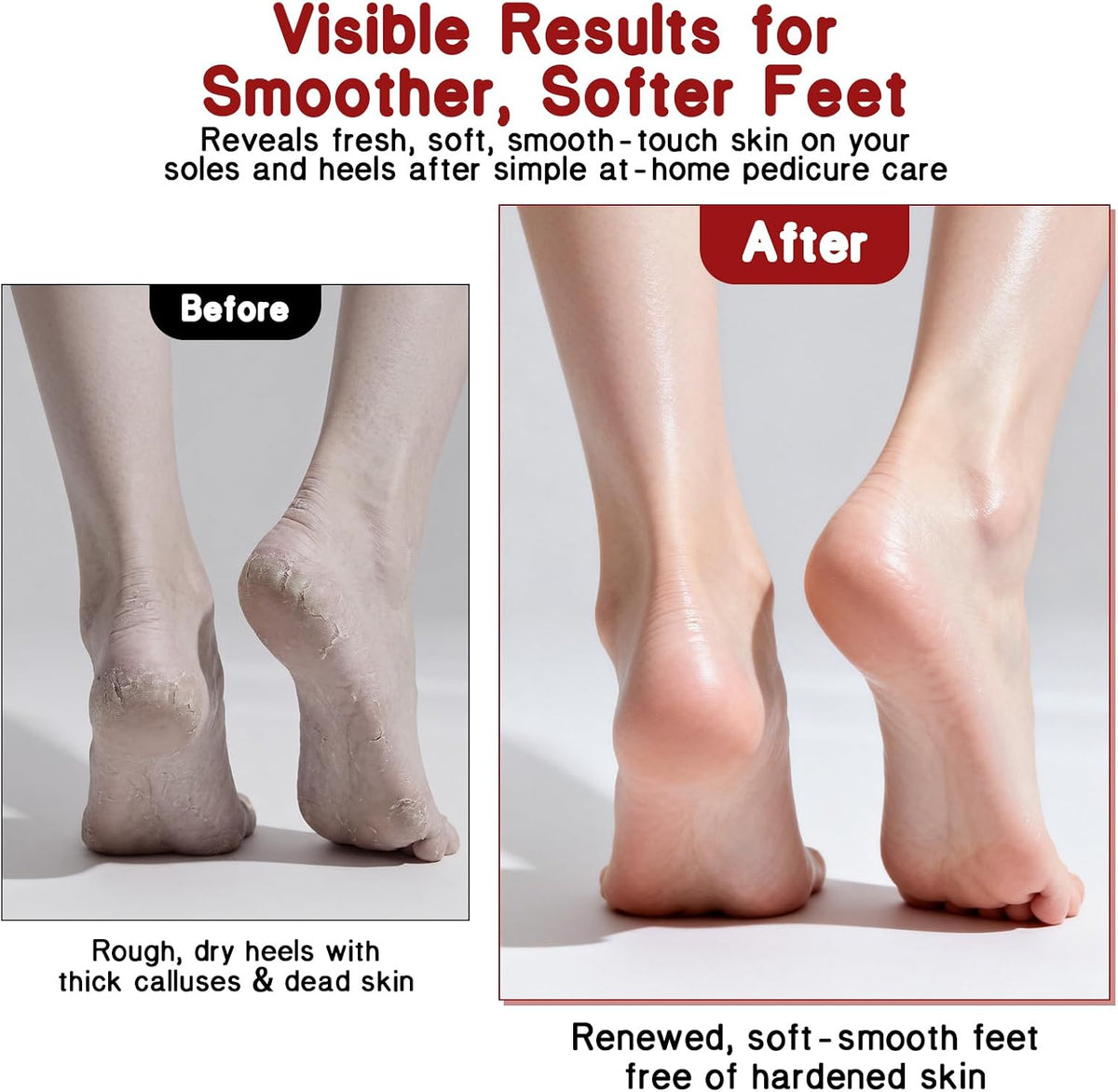 2-Sided Foot File & Callus Rasp, Steel Scraper for Dead Skin, Home Pedicure