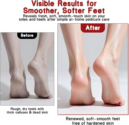 2-Sided Foot File & Callus Rasp, Steel Scraper for Dead Skin, Home Pedicure