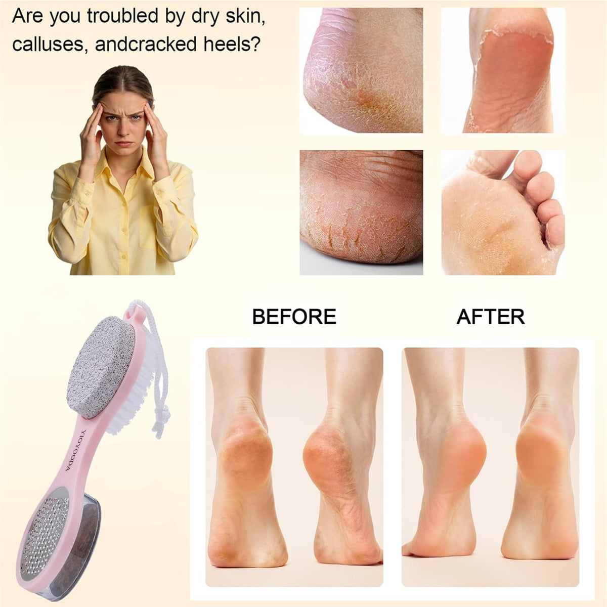 Foot Scrubber Brush with Pumice Stone for Feet Callus Remover Pedicure Tool