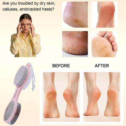 Foot Scrubber Brush with Pumice Stone for Feet Callus Remover Pedicure Tool