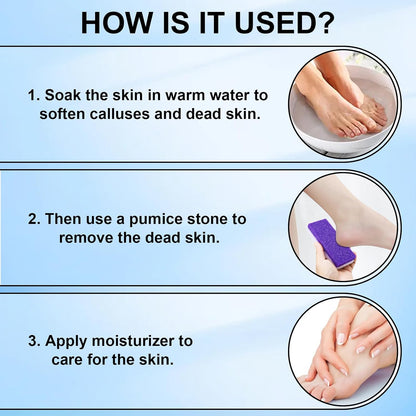 Foot Pumice Stone 2 Pack Pedicure Stone for Feet (Purple)