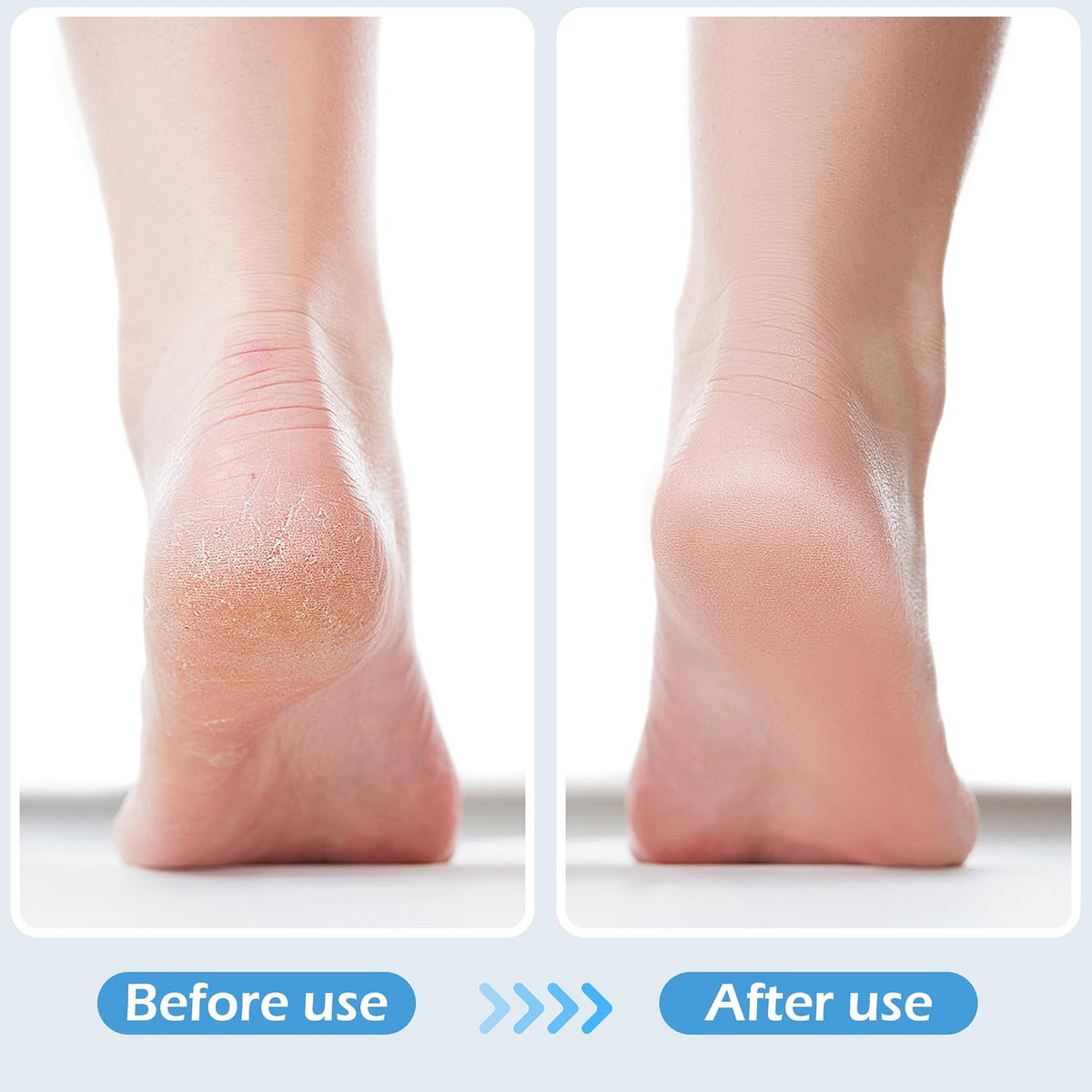 3 Pcs 4-in-1 Foot Scrubber Brush for Feet & Shower
