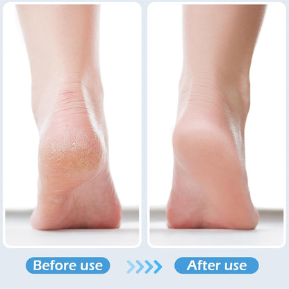 3 Pcs 4-in-1 Foot Scrubber Brush for Feet & Shower