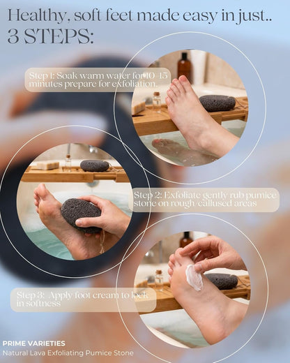 Pumice Stone for Feet, 2 Pack Natural Volcanic Foot Pumice Stone for Callus & Dead Skin Removal, Pedicure Foot Scrubber, Hard Skin Remover for Smooth Heels