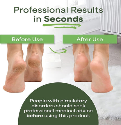 Pumice Stone for feet Extra Large Foot File & Callus Remover for Cracked Heels Double Sided Pedicure Tool for Dead Skin Podiatrist Recommended