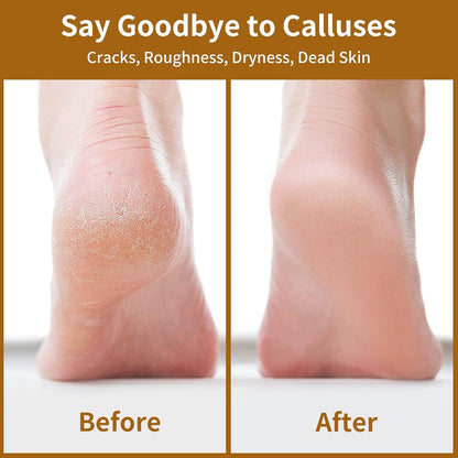Nano Glass Foot File, Double-Sided Foot Callus Remover for Cracked Heels