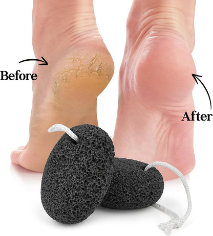 SALVMARY Natural Pumice Stone for Feet Foot Scrubber Callus Remover 2 Pack