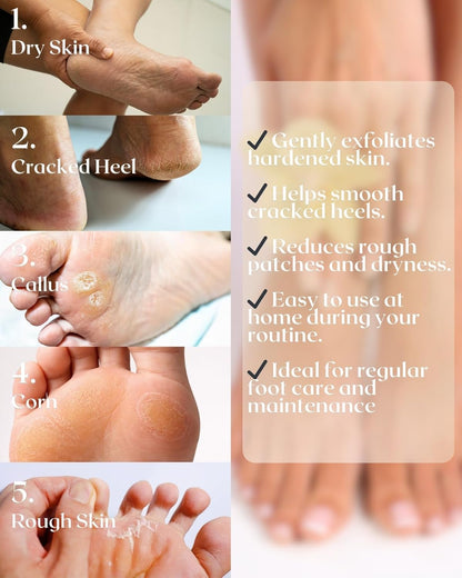 Pumice Stone for Feet, 2 Pack Natural Volcanic Foot Pumice Stone for Callus & Dead Skin Removal, Pedicure Foot Scrubber, Hard Skin Remover for Smooth Heels