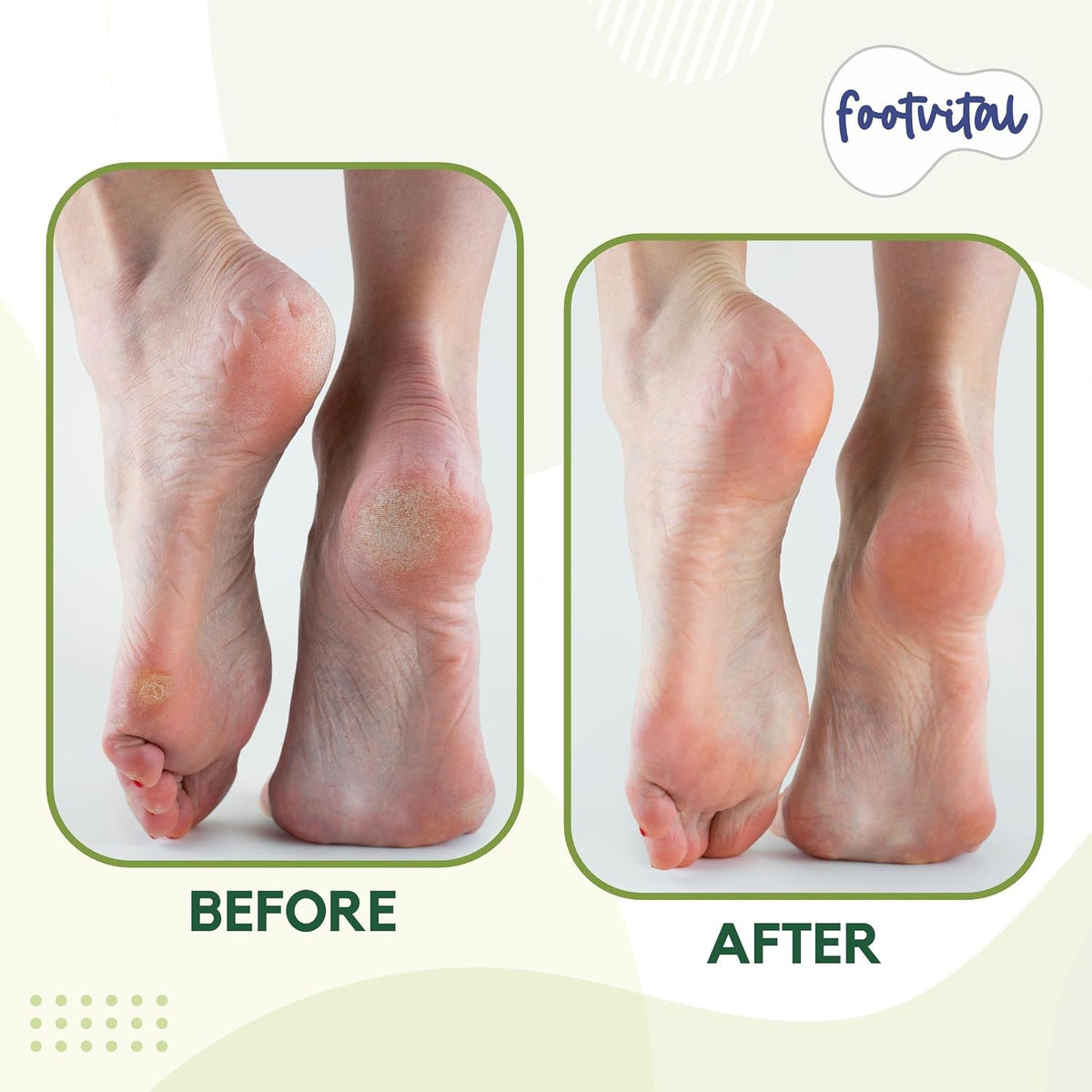 Pumice Stone for Feet Callus Remover - Terra-Cotta Foot Scrubber with 2 Sides, 100% Pure Natural Foot Pumice Stone, Pedicure Scrubber, Foot Exfoliator, Removes Calluses & Dead Skin