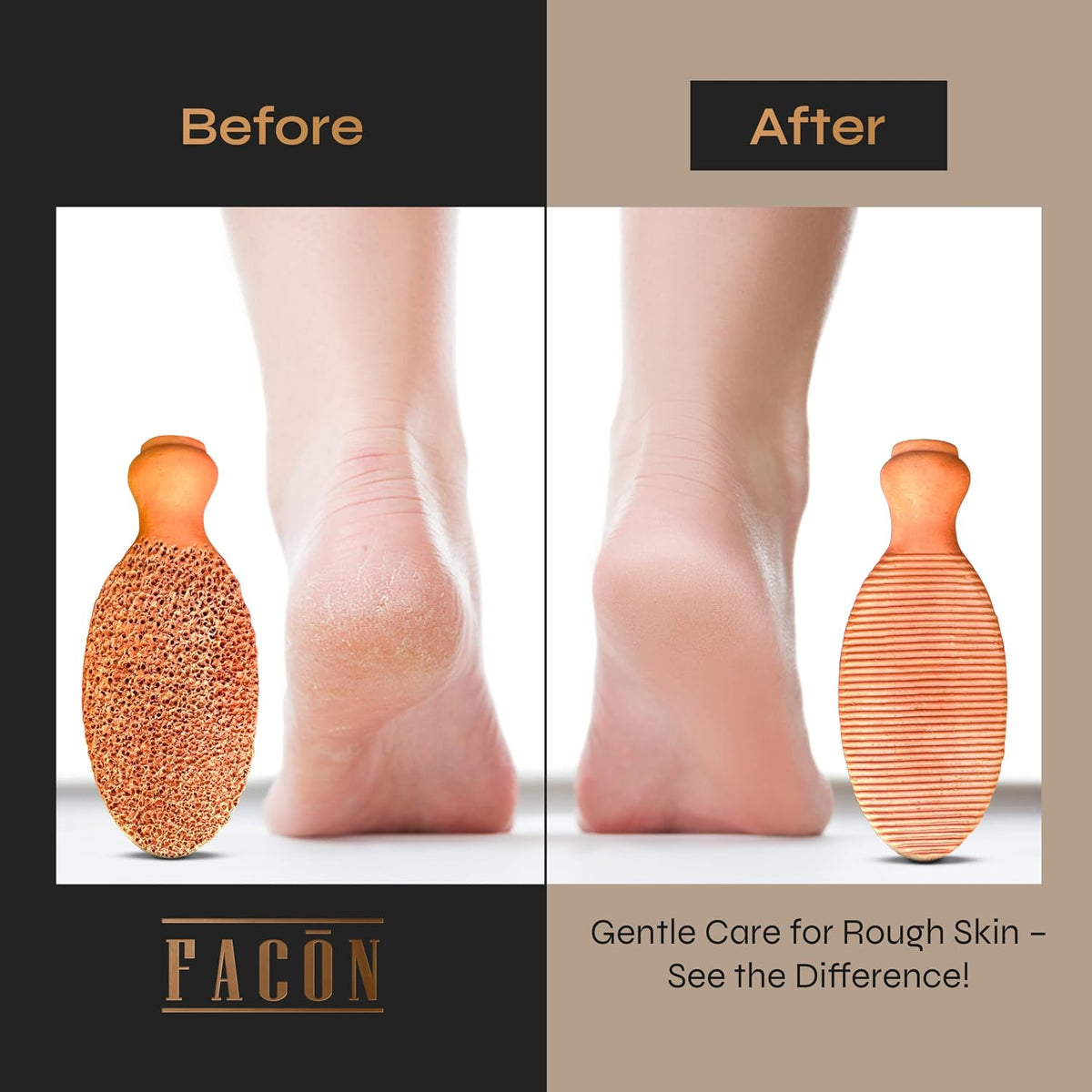 Facón Pumice Stone for Feet Callus Remover - Terra-Cotta Foot Scrubber with 2 Sides, 100% Pure Natural Foot Pumise Stone, Pedicure Pumice Stone Scrubber, Foot Exfoliator, Removes Calluses & Dead Skin