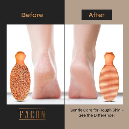 Facón Pumice Stone for Feet Callus Remover - Terra-Cotta Foot Scrubber with 2 Sides, 100% Pure Natural Foot Pumise Stone, Pedicure Pumice Stone Scrubber, Foot Exfoliator, Removes Calluses & Dead Skin