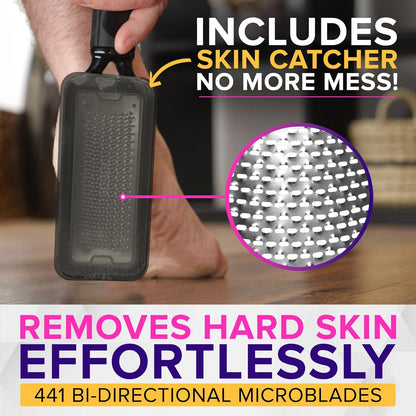 NYK1 RUSTPROOF Foot File Callus Remover for Feet with Catcher | XL Size