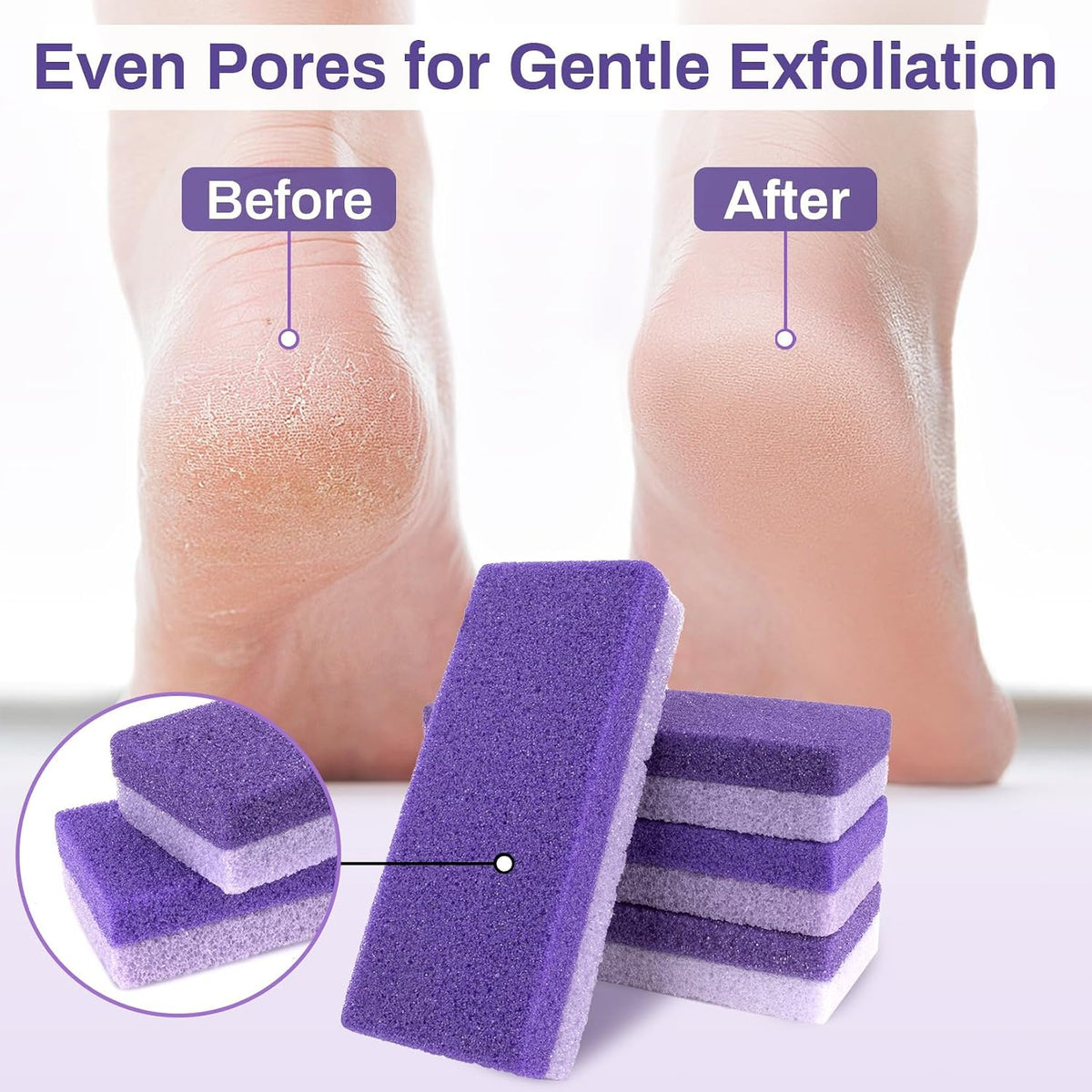 10 Pumice Stone for Feet - 4.7"x2"x1" Double Side Foot Pumice Stone